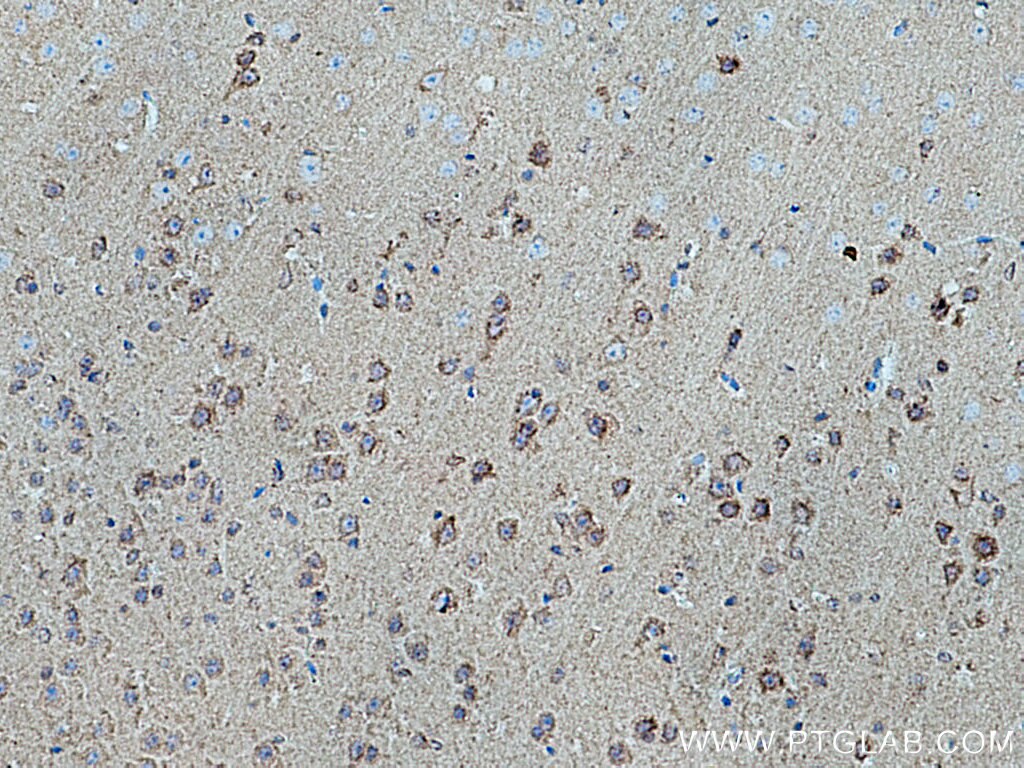 IHC staining of mouse brain using 10944-1-AP