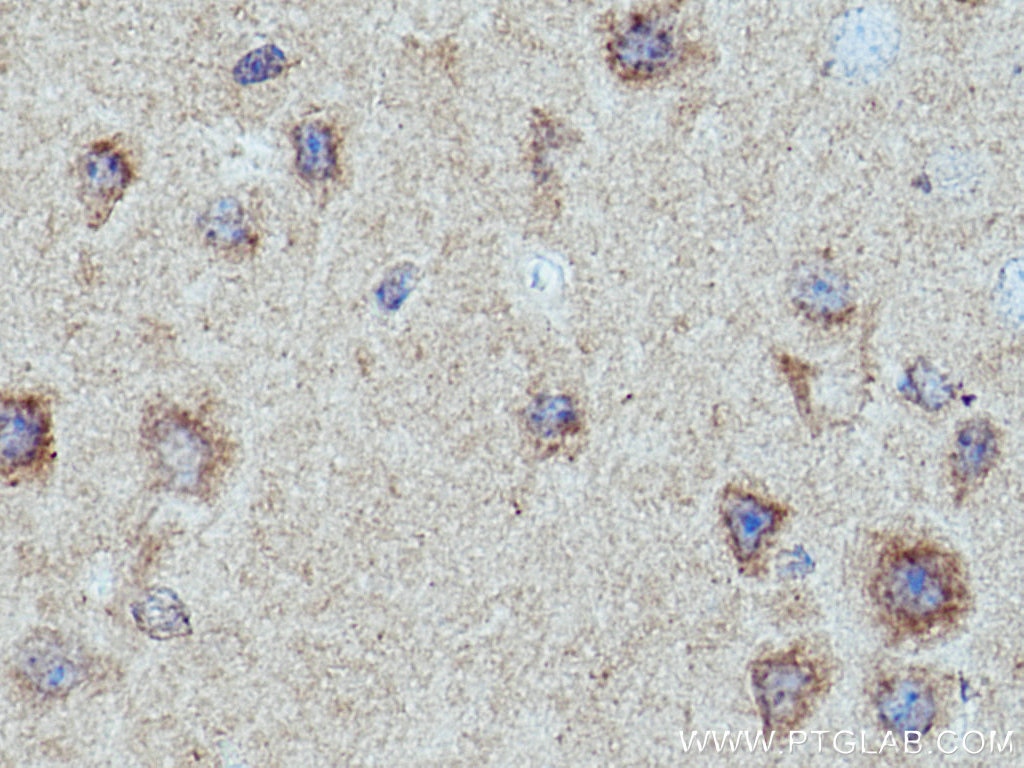 IHC staining of mouse brain using 10944-1-AP