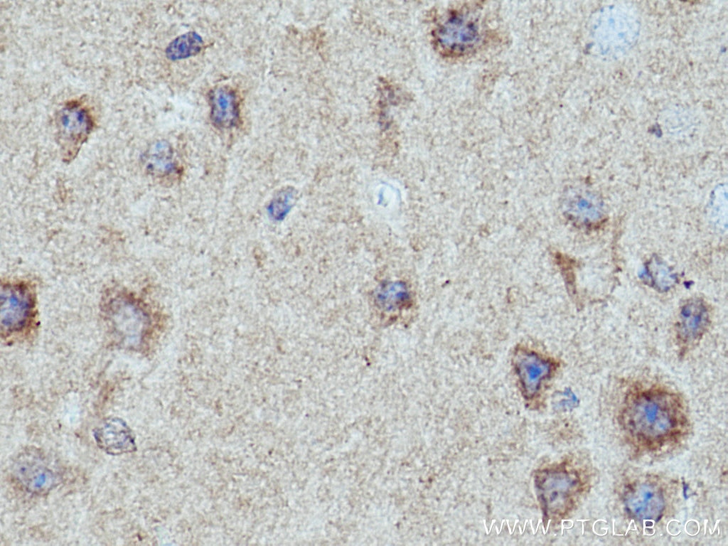 Immunohistochemistry (IHC) staining of mouse brain tissue using CRH/CRF Polyclonal antibody (10944-1-AP)