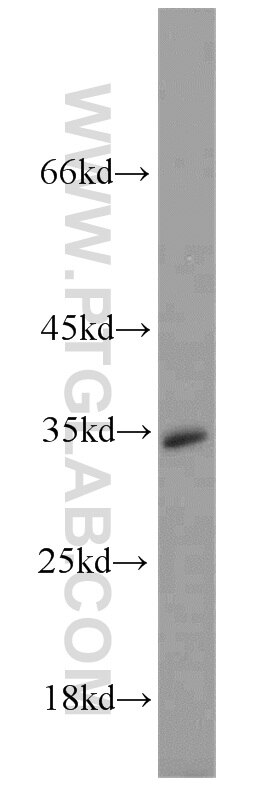 Western Blot (WB) analysis of rat brain tissue using CRH/CRF Polyclonal antibody (10944-1-AP)