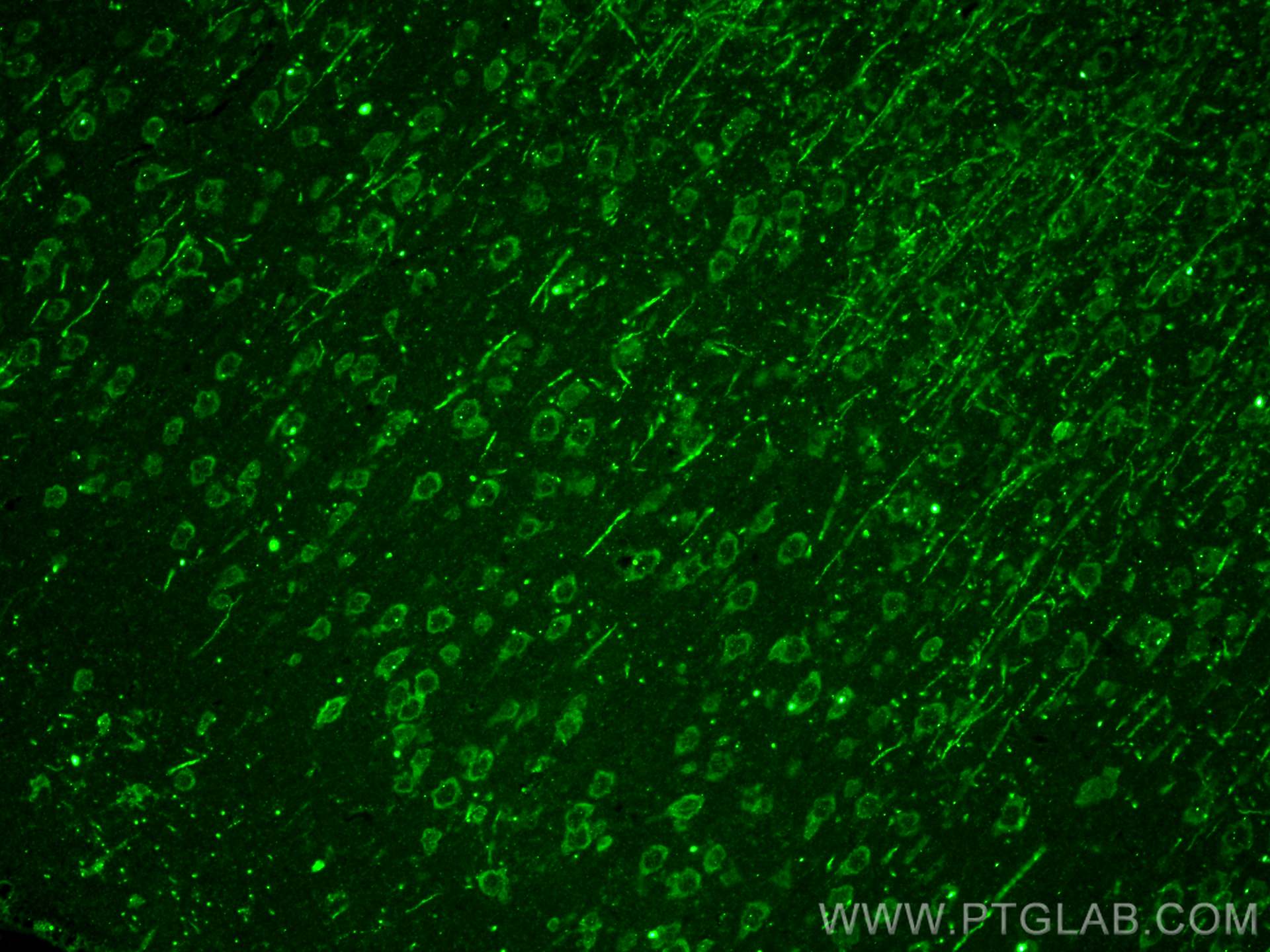 Immunofluorescence (IF) / fluorescent staining of rat brain tissue using CRH/CRF Polyclonal antibody (26848-1-AP)