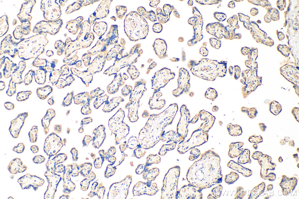 Immunohistochemistry (IHC) staining of human placenta tissue using CRH/CRF Polyclonal antibody (26848-1-AP)