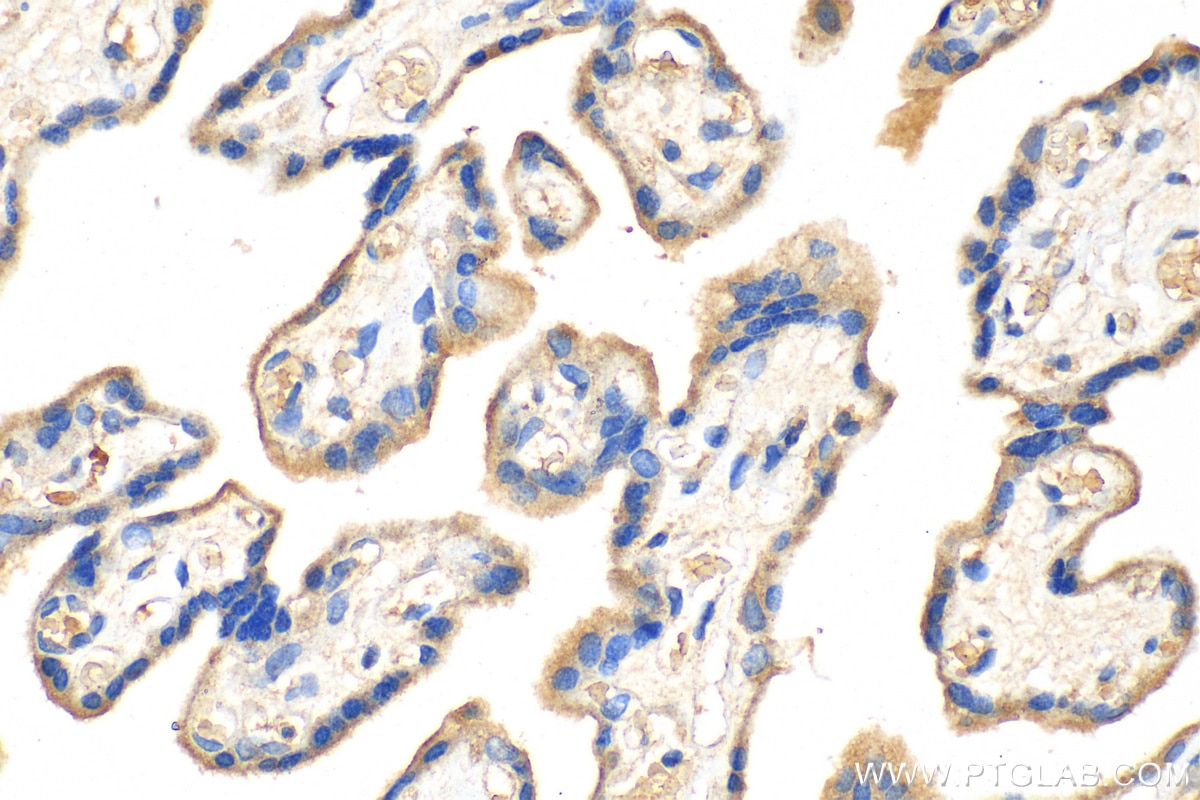 Immunohistochemistry (IHC) staining of human placenta tissue using CRH/CRF Polyclonal antibody (26848-1-AP)