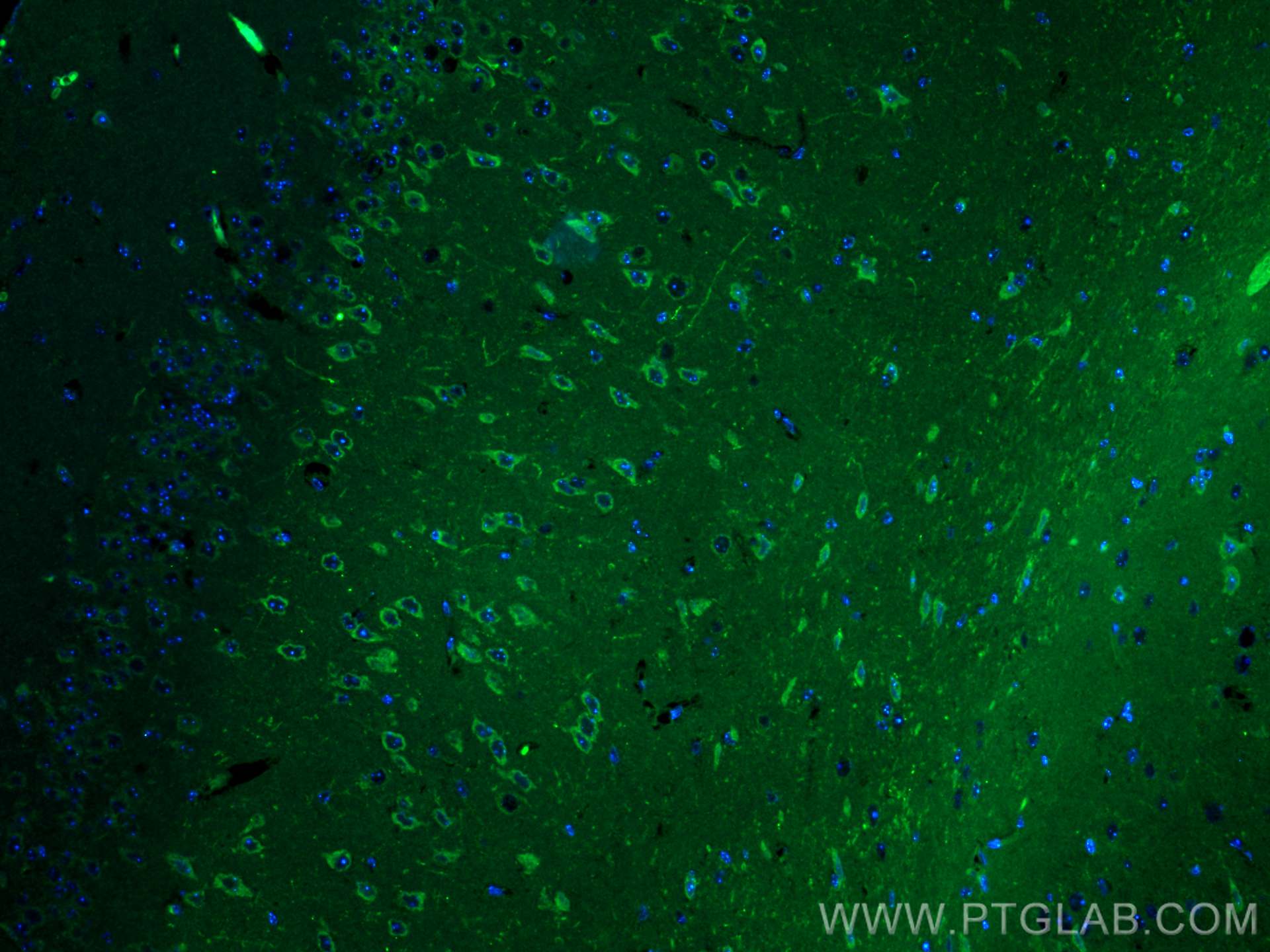 Immunofluorescence (IF) / fluorescent staining of mouse brain tissue using CoraLite® Plus 488-conjugated CRH/CRF Polyclonal a (CL488-10944)
