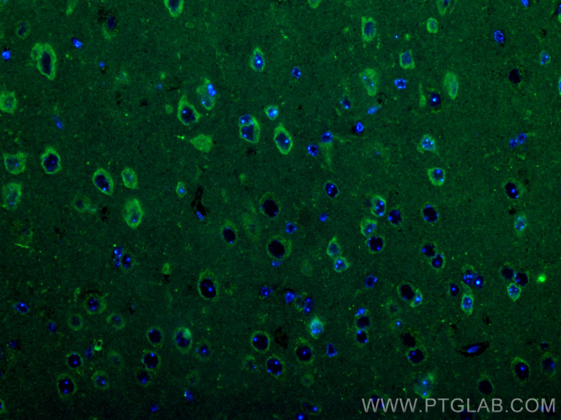 Immunofluorescence (IF) / fluorescent staining of mouse brain tissue using CoraLite® Plus 488-conjugated CRH/CRF Polyclonal a (CL488-10944)