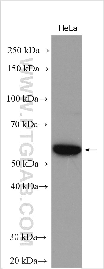 Western Blot (WB) analysis of HeLa cells using CRHR1 Polyclonal antibody (20967-1-AP)