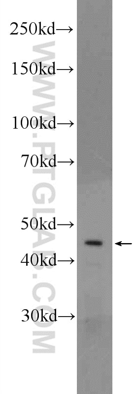 WB analysis of SH-SY5Y using 20967-1-AP