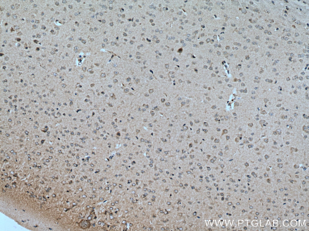 Immunohistochemistry (IHC) staining of mouse brain tissue using CRHR2 Polyclonal antibody (25267-1-AP)