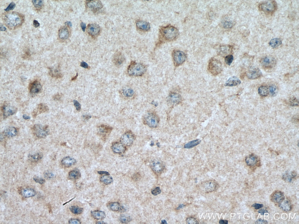 Immunohistochemistry (IHC) staining of mouse brain tissue using CRHR2 Polyclonal antibody (25267-1-AP)