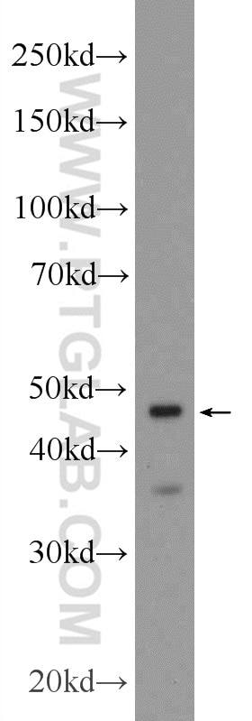 Western Blot (WB) analysis of mouse heart tissue using CRHR2 Polyclonal antibody (25267-1-AP)