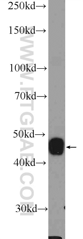 Western Blot (WB) analysis of rat skeletal muscle tissue using CRHR2 Polyclonal antibody (25267-1-AP)