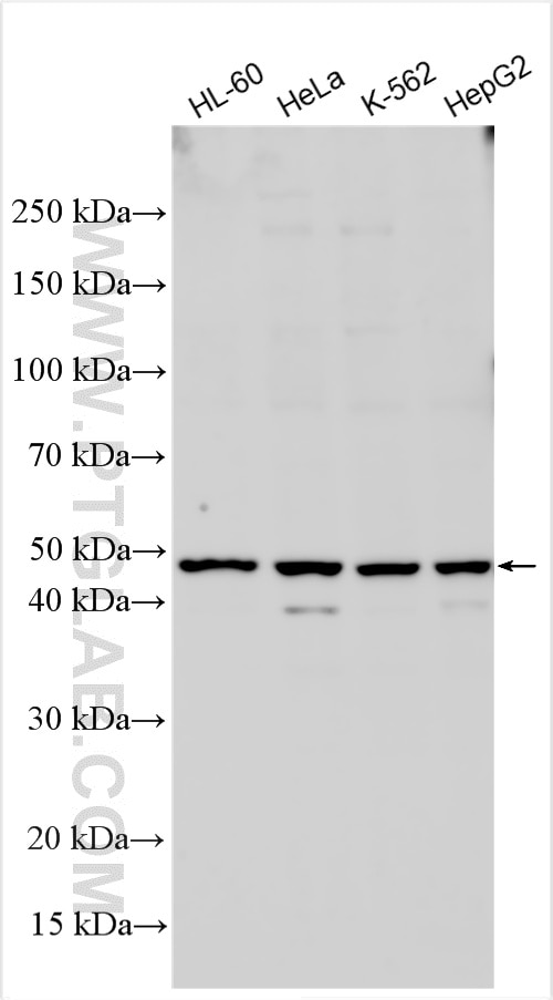 Western Blot (WB) analysis of various lysates using CRHR2 Polyclonal antibody (25267-1-AP)