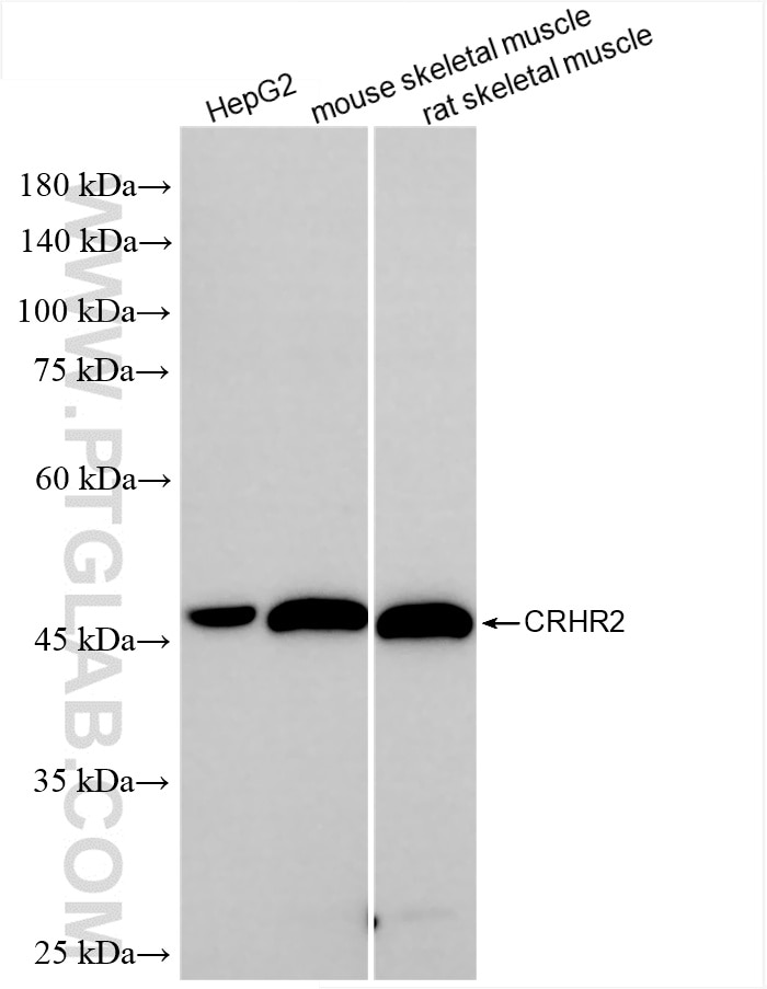 Western Blot (WB) analysis of various lysates using CRHR2 Recombinant antibody (85785-1-RR)