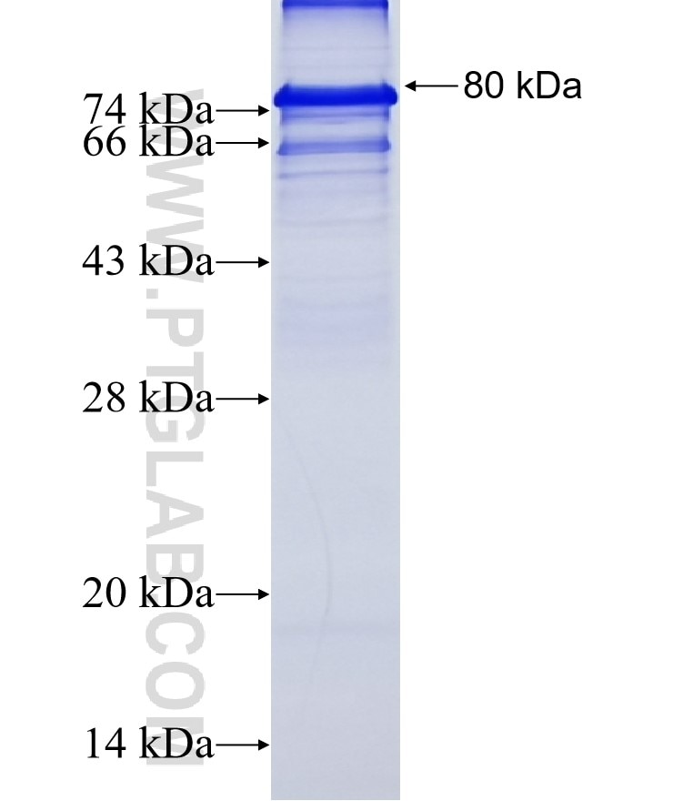 CRIM1 fusion protein Ag16349 SDS-PAGE