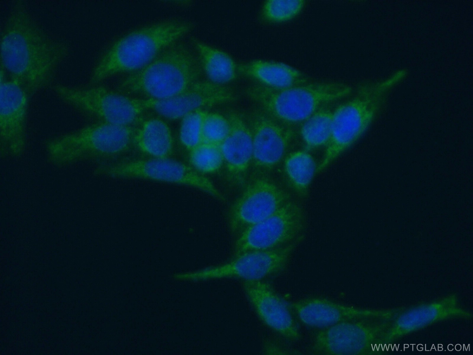 Immunofluorescence (IF) / fluorescent staining of HeLa cells using CRIP1 Polyclonal antibody (15349-1-AP)