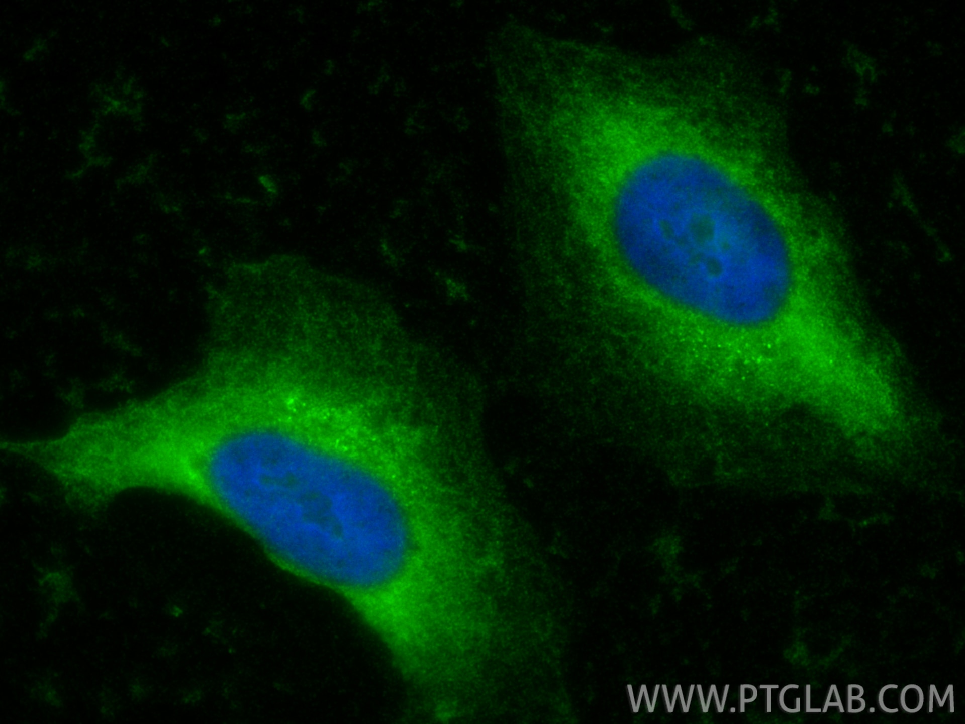 Immunofluorescence (IF) / fluorescent staining of HeLa cells using CRIP1 Polyclonal antibody (15349-1-AP)