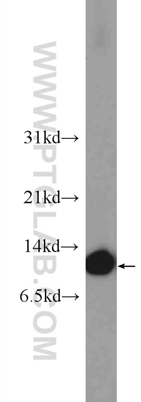 Western Blot (WB) analysis of PC-3 cells using CRIP1 Polyclonal antibody (15349-1-AP)