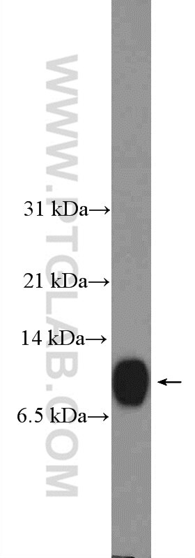 Western Blot (WB) analysis of HeLa cells using CRIP1 Polyclonal antibody (15349-1-AP)