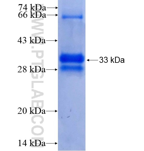 CRIP1 fusion protein Ag7588 SDS-PAGE
