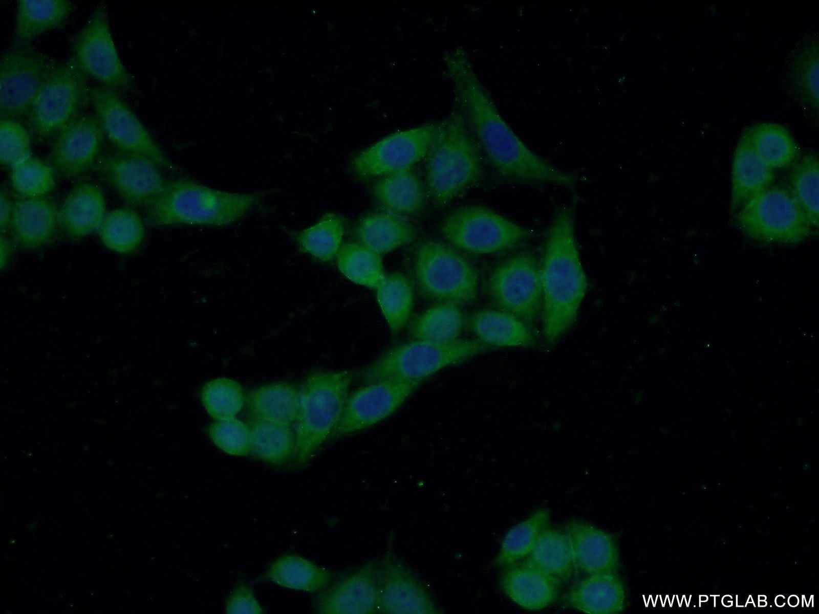 Immunofluorescence (IF) / fluorescent staining of HeLa cells using CRIP2 Polyclonal antibody (14801-1-AP)