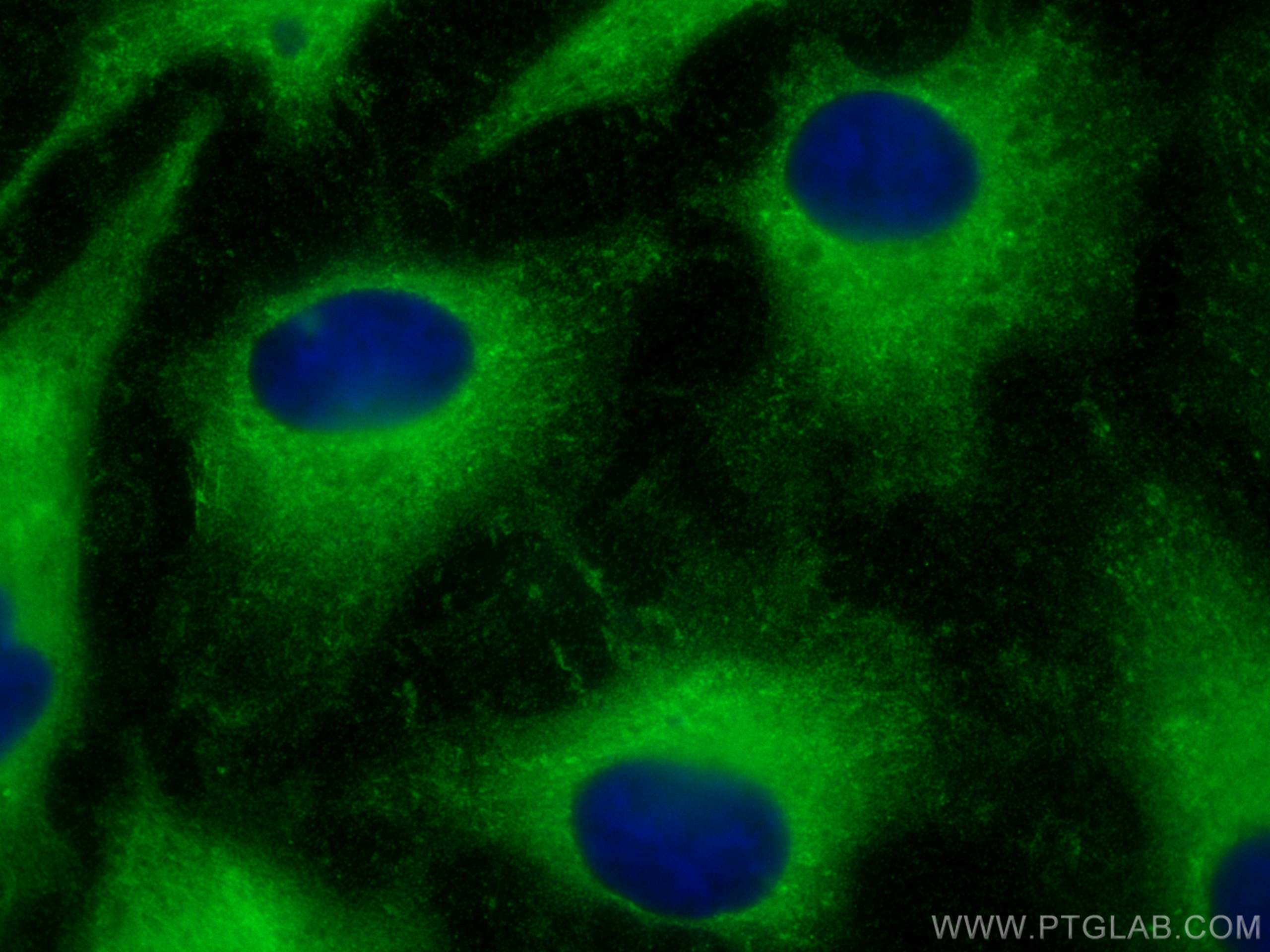 Immunofluorescence (IF) / fluorescent staining of HeLa cells using CRIP2 Polyclonal antibody (14801-1-AP)