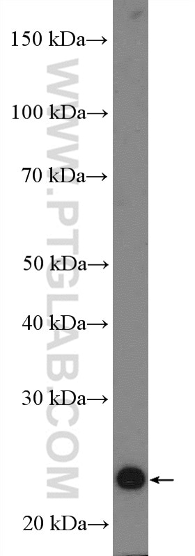 Western Blot (WB) analysis of mouse heart tissue using CRIP2 Polyclonal antibody (14801-1-AP)