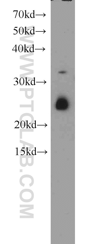 Western Blot (WB) analysis of MCF-7 cells using CRIP2 Polyclonal antibody (14801-1-AP)