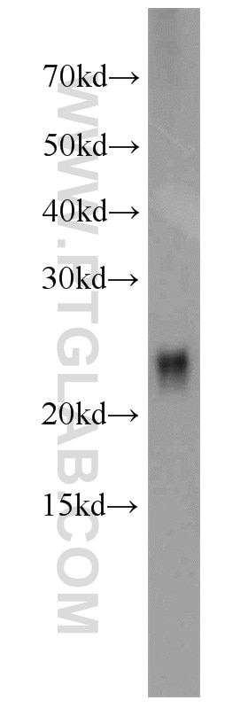 Western Blot (WB) analysis of mouse brain tissue using CRIP2 Polyclonal antibody (14801-1-AP)