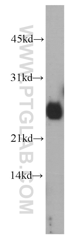 Western Blot (WB) analysis of HeLa cells using CRIP2 Polyclonal antibody (14801-1-AP)