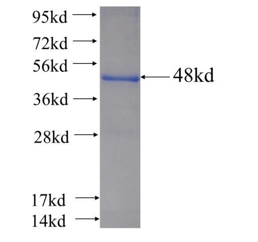 CRIP2 fusion protein Ag6515 SDS-PAGE