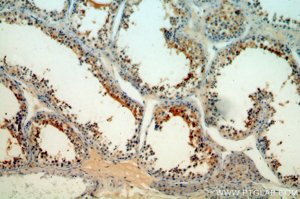 IHC staining of human testis using 19066-1-AP