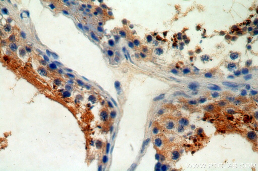 Immunohistochemistry (IHC) staining of human testis tissue using CRISP2 Polyclonal antibody (19066-1-AP)