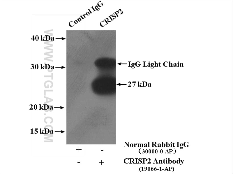Immunoprecipitation (IP) experiment of mouse testis tissue using CRISP2 Polyclonal antibody (19066-1-AP)