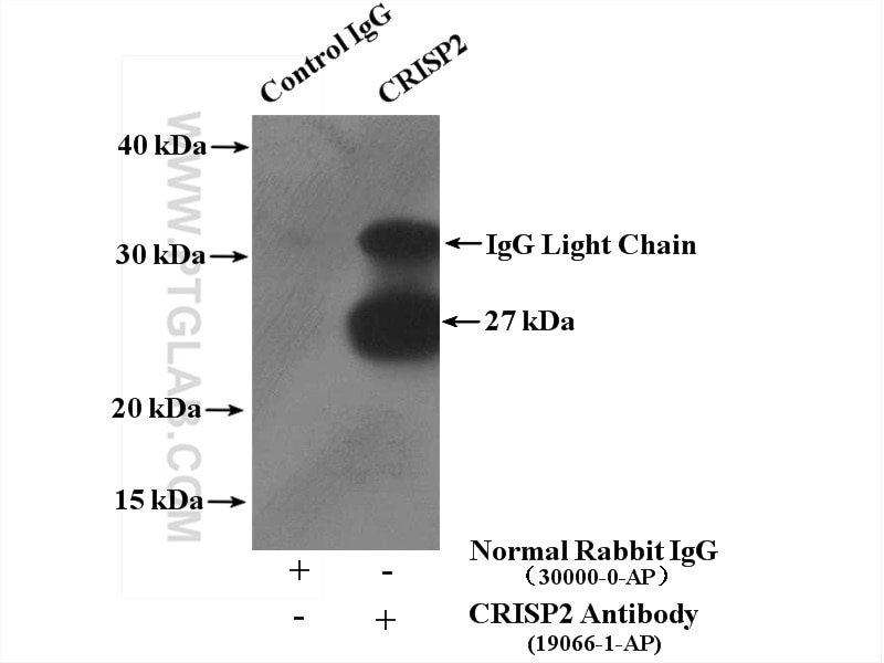 IP experiment of mouse testis using 19066-1-AP