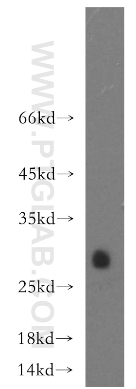 Western Blot (WB) analysis of human testis tissue using CRISP2 Polyclonal antibody (19066-1-AP)