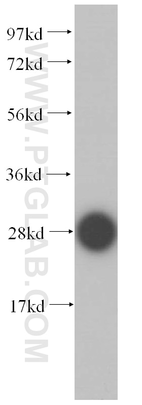 Western Blot (WB) analysis of mouse thymus tissue using CRISP3 Polyclonal antibody (14843-1-AP)