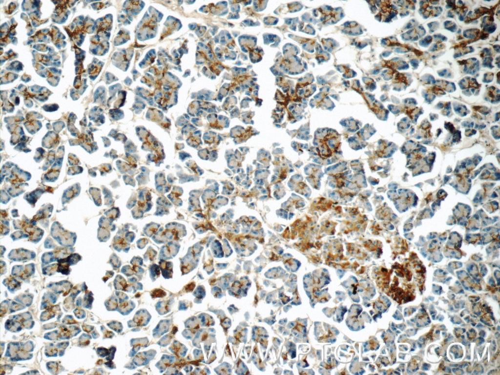 Immunohistochemistry (IHC) staining of human pancreas tissue using CRISP3 Polyclonal antibody (14847-1-AP)