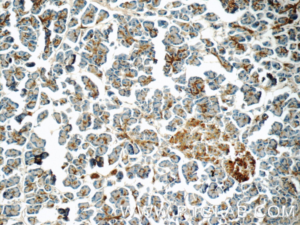 IHC staining of human pancreas using 14847-1-AP