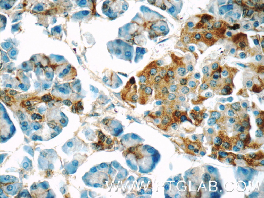 Immunohistochemistry (IHC) staining of human pancreas tissue using CRISP3 Polyclonal antibody (14847-1-AP)