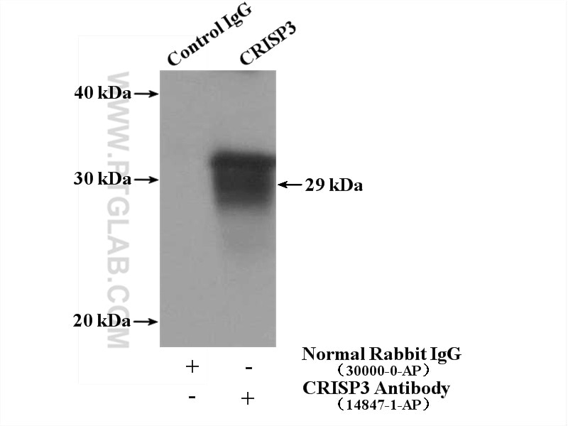 Immunoprecipitation (IP) experiment of human placenta tissue using CRISP3 Polyclonal antibody (14847-1-AP)
