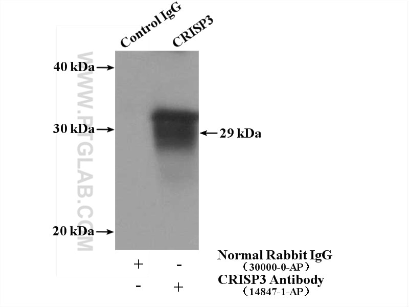 IP experiment of human placenta using 14847-1-AP