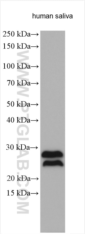 Western Blot (WB) analysis of various lysates using CRISP3 Polyclonal antibody (14847-1-AP)