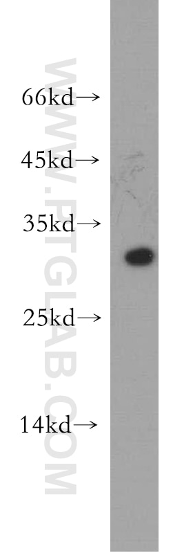 Western Blot (WB) analysis of mouse ovary tissue using CRISP3 Polyclonal antibody (14847-1-AP)