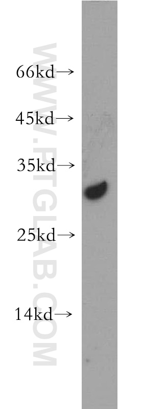 Western Blot (WB) analysis of mouse ovary tissue using CRISP3 Polyclonal antibody (14847-1-AP)