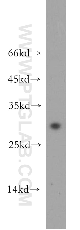 Western Blot (WB) analysis of mouse colon tissue using CRISP3 Polyclonal antibody (14847-1-AP)