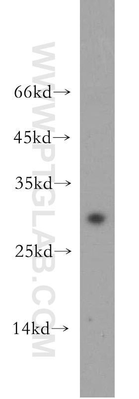 WB analysis of mouse colon using 14847-1-AP