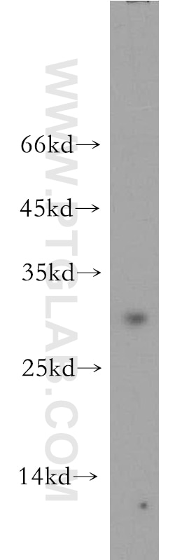 Western Blot (WB) analysis of mouse colon tissue using CRISP3 Polyclonal antibody (14847-1-AP)