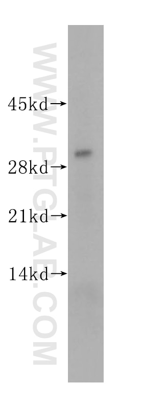 Western Blot (WB) analysis of human placenta tissue using CRISP3 Polyclonal antibody (14847-1-AP)