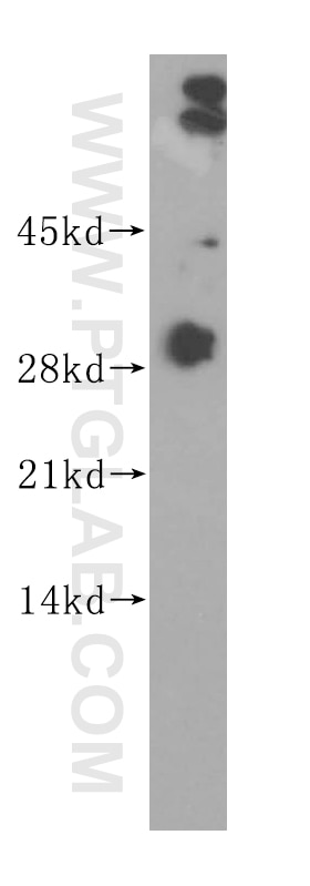 Western Blot (WB) analysis of Jurkat cells using CRISP3 Polyclonal antibody (14847-1-AP)