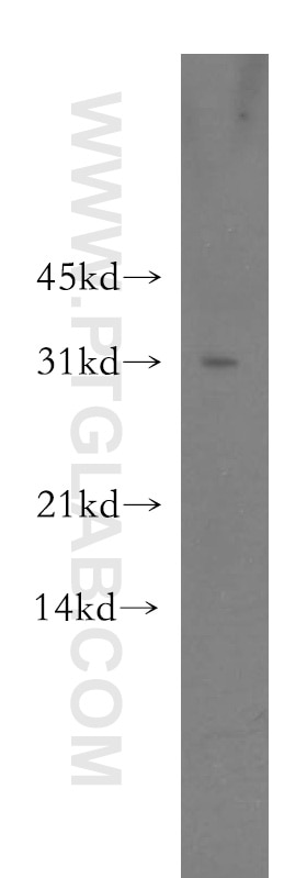 Western Blot (WB) analysis of HEK-293 cells using CRISP3 Polyclonal antibody (51022-1-AP)